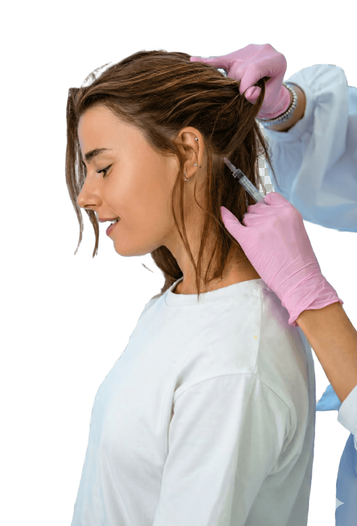 Mésothérapie Cheveux